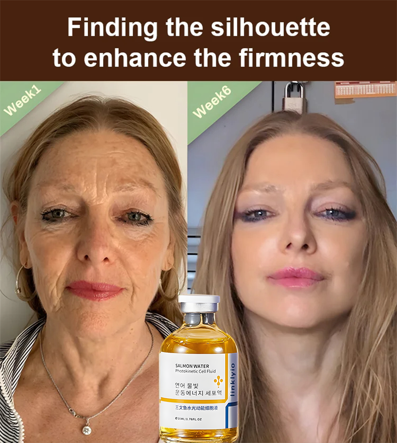 🔥BUY 1 GET 1 FREE🔥Salmon Water Light Anti-Wrinkle Essence