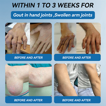 Official store 👩‍⚕️🥇| NATRAVOR® BPC-157 Joint Healing Cream🏃‍Treats Arthritis,Neuropathy,Rheumatism,Sports Injuries&More👍